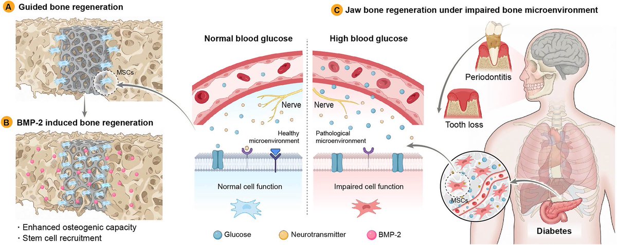 MedicalReviewJ's tweet photo. Endogenous jaw bone regeneration: past, present, and future

https://t.co/4RCIUgY4lN https://t.co/4WAVyihyvM