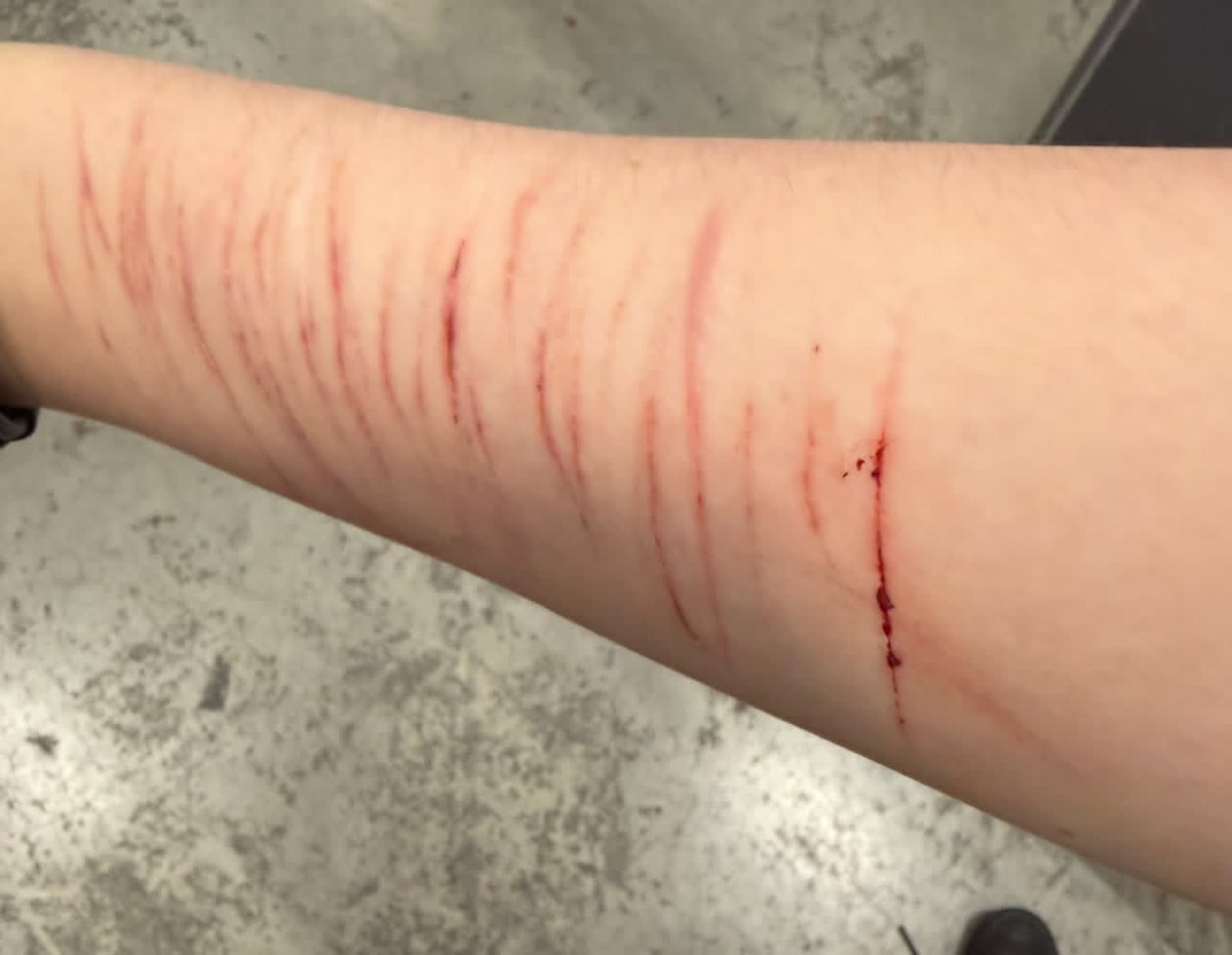 MmaNurse_15's tweet photo. ⚠️ SELF-HARM AWARENESS ⚠️

Have you ever wondered why some people cut themselves?

Contrary to popular belief, most cutters are not trying to die, and many are not seeking attention.

#SelfHarmAwareness #M #DepressionAwareness #BeKind #YouAreNotAlone https://t.co/BH8qtKz0z8