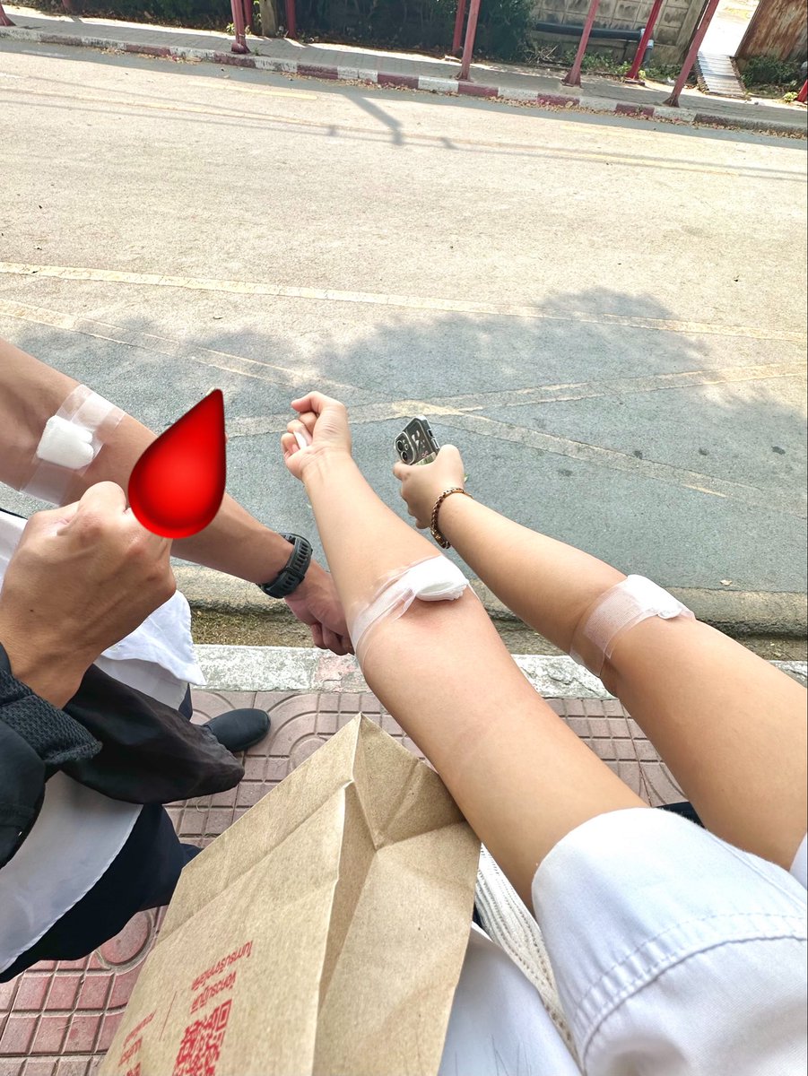 opel_zuza's tweet photo. ใครที่ร่างกายพร้อมไปบริจาคเลือดกันเถอะฮะ มันต่อชีวิตคนได้อีกเยอะจริงๆ นี่อยากทำตั้งแต่เด็กๆ แต่เราค่อนข้างตัวเล็ก เลือดไม่ค่อยข้น คุณหมอเลยไม่แนะนำ เลยพยายามขุนตัวเอง กินครบ5หมู่ (กินเกาเหลาเลือดหมู1วีคก่อนวัน เพราะไม่กินเครื่องใน) + นอน7ชั่วโมงขึ้น + ดื่มน้ำเปล่าเยอะๆ น้ำหนักเลยขึ้นมาถึง 48kg สรุปเพิ่งจะบริจาคได้ครั้งแรกตอนปีที่แล้ว ดีใจจนร้องไห้อะ อันนี้เราไปบริจาคที่มอกับที่สภากาชาดไทยฮะ 🥹