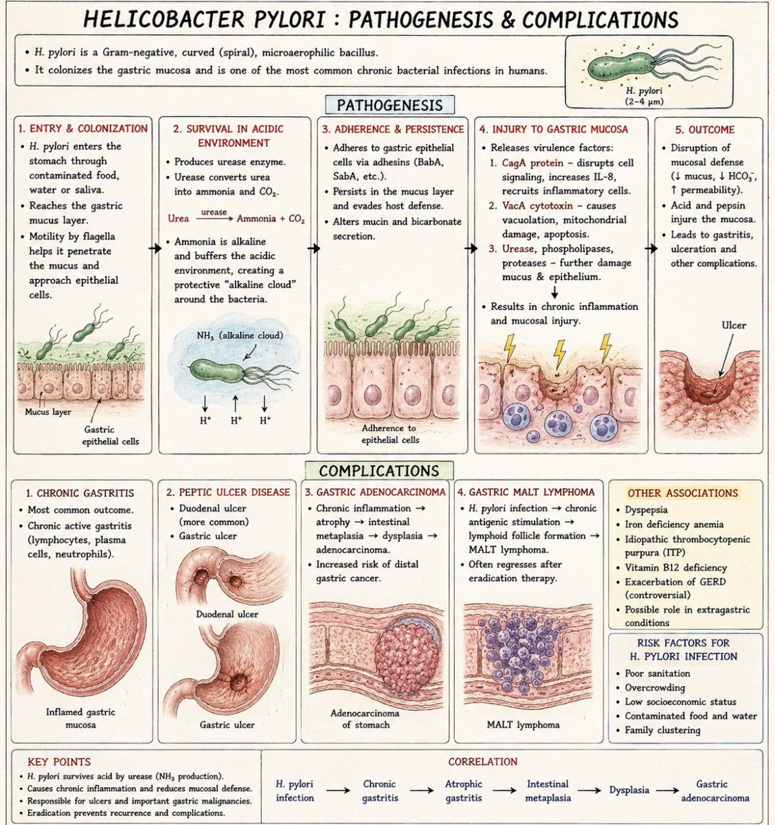 Dr_Shiv_kumar_'s tweet photo. Ans:- H. pylori infection 
It  is one of the few bacteria that can survive stomach acid. 

It uses urease to create an alkaline shield, burrows into the stomach lining, triggers chronic inflammation, causes ulcers, and can even lead to gastric cancer.

That’s why treatment included multiple drugs, hits it from all sides:
🔻Omeprazole decreases acid,
🔻Bismuth protects & damages the bug,
🔻Amoxicillin breaks its cell wall,
🔻Metronidazole destroys its DNA.