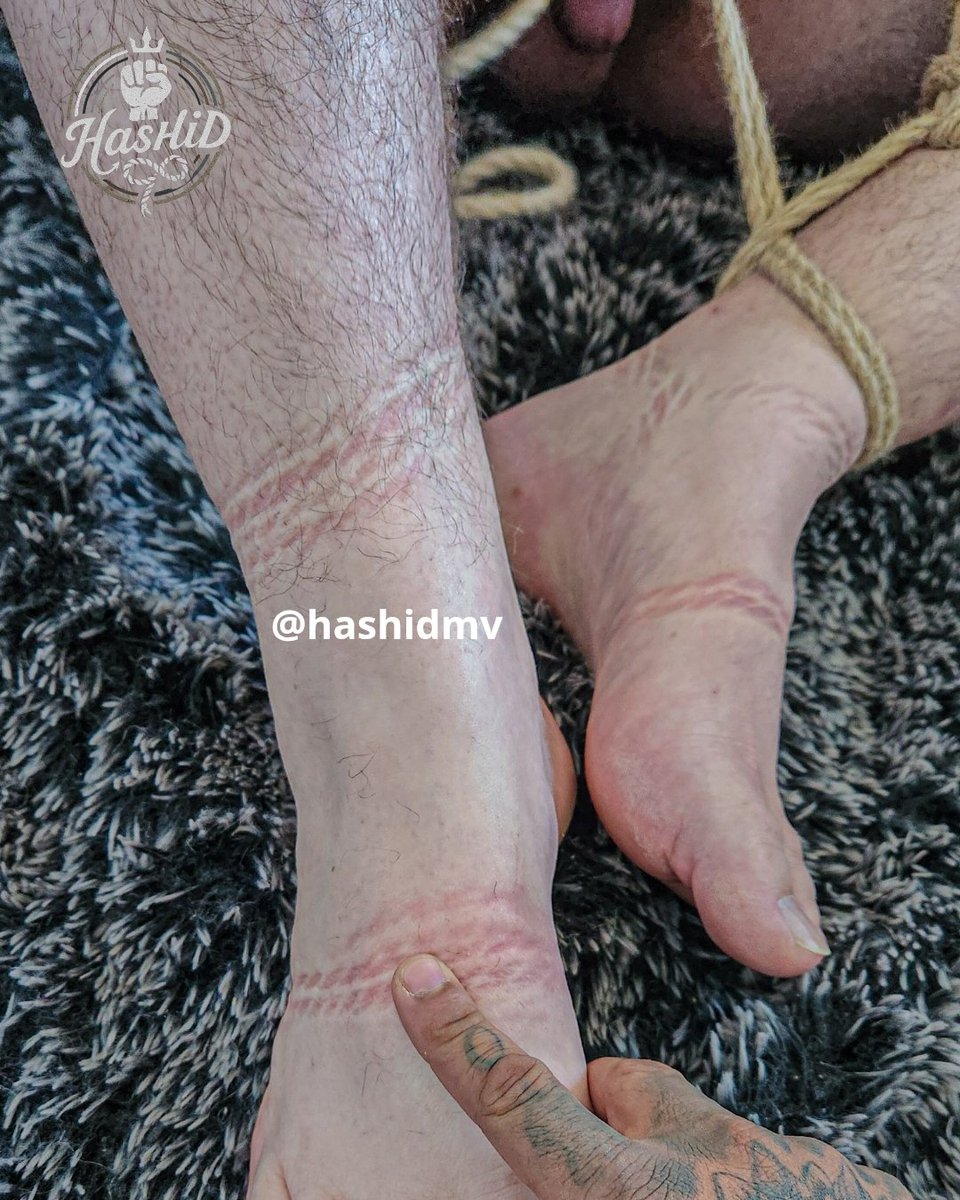 hashidmv's tweet photo. Bom diaa, roped and imprited ⛓️🥵😷 https://t.co/f6S7tHdxOK