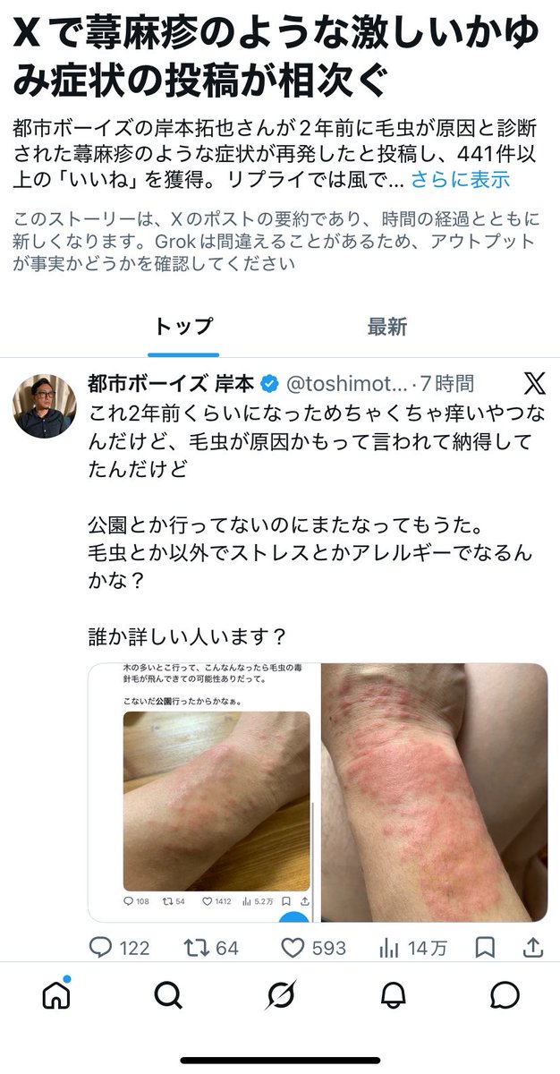toshimoto0928's tweet photo. 皆さん色々と症状についてコメントありがとうございます。

虫かストレス以外にもこんな色々と原因があるとは知りませんでした！

Xがこのポストをまとめてたみたいなんですが、1行目から間違ってるので絶対に参考にしないで下さい。 https://t.co/fwcaGeP7xi