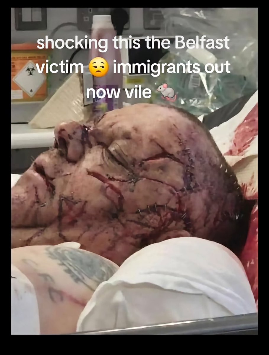 Emel_Michael's tweet photo. @TRobinsonNewEra @WatchdogTh96012 https://t.co/aybklzrQF1
