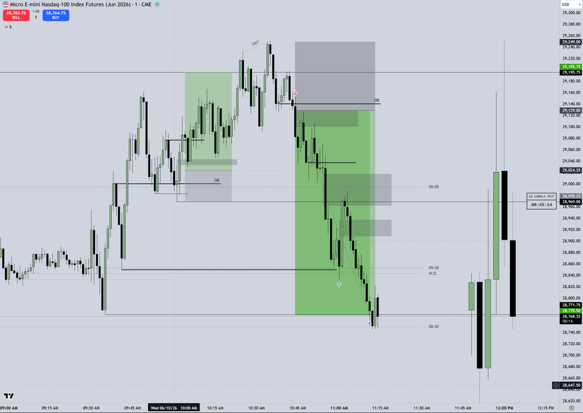 imTylerTrades's tweet photo. W shorts on stream this morning

+400 points caught in 11am macro

The Tradovate account disruption couldn't hold us down! https://t.co/wvfVh47Ij9
