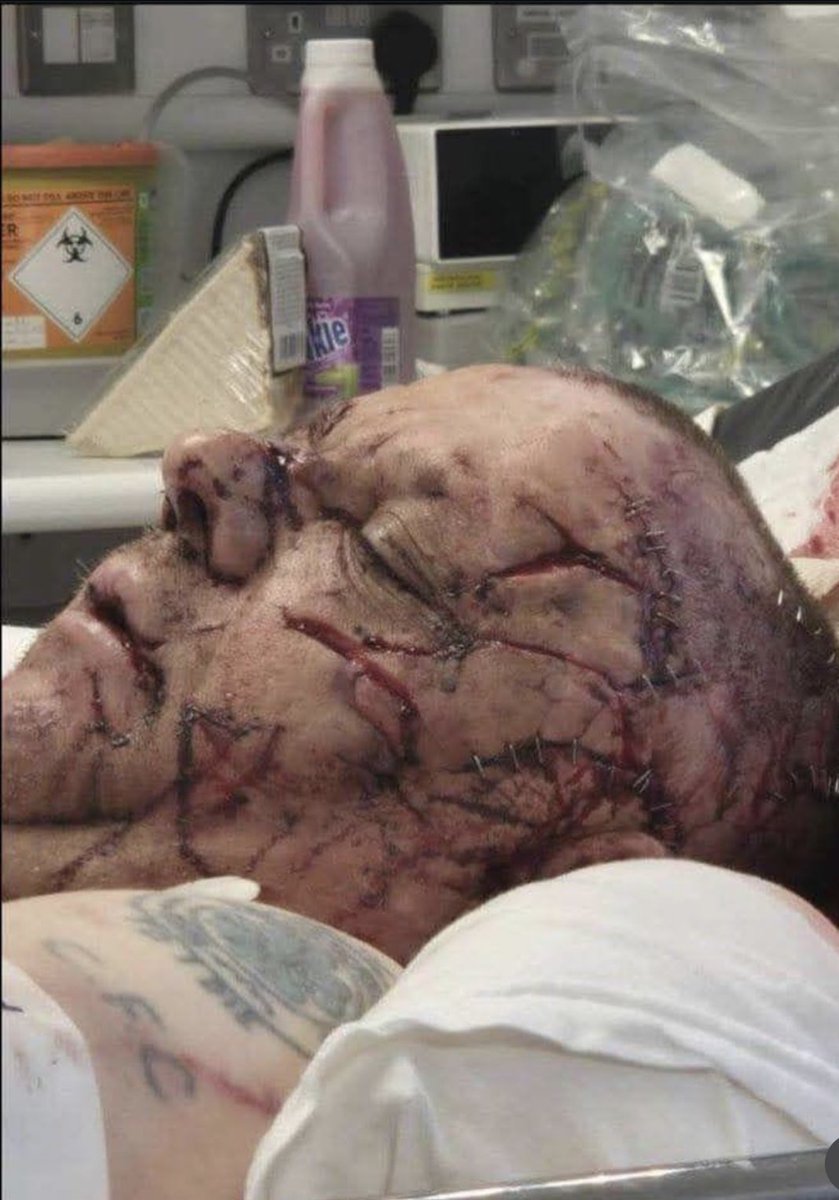 TruePatriotsCA's tweet photo. The victim of the Belfast attempted beheading has been identified: Stephen Ogilvie, a disabled Scottish man in his 40s.

Neighbours say he was vulnerable, lived alone, and 'would have helped anyone!' https://t.co/Nl8PnVuLRS