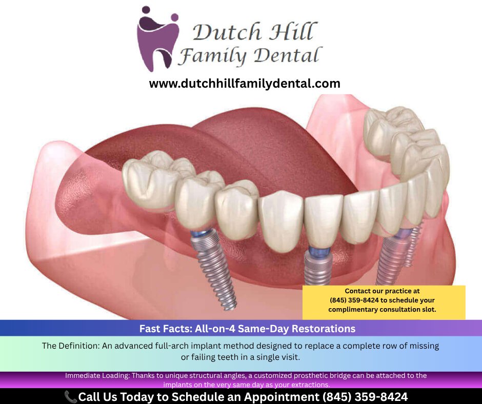 dutchhillfamily's tweet photo. Restore 100% biting power. Eat your favorite foods again without pain. Call (845) 359-8424 or visit https://t.co/SdzQ1WR2uX today. #rocklandcounty #allonfour #implants #dentures #dentist #ny #smile #oralsurgery #pearlriver #nyack #suffern #hudsonvalley #teeth #dental #restoration https://t.co/nAXUx0xv9m