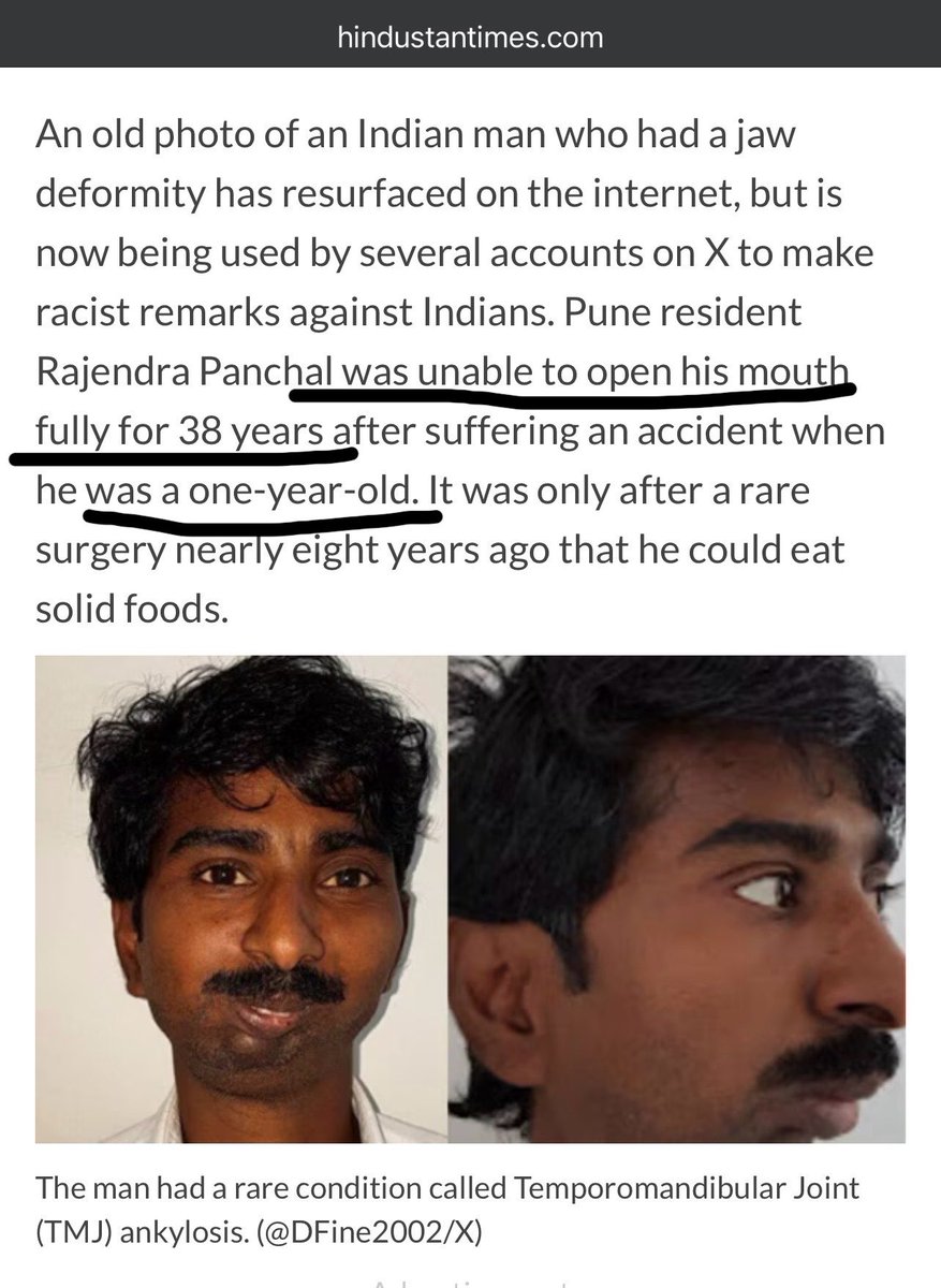 chanakyaspeakss's tweet photo. HINDU WOMEN HATING AND DISOWNING THEIR OWN MEN FOR THEIR LOOKS

Did you ever come across various X handles of Hindu/Indian women/Girls with beautiful PFPs and constantly demeaning and demonizing their own Men,religion and their own community as a whole? 

If Yes, then there are high chances that those accounts are run by some Madarsa Grade Jihadi Katmullas to create social and cultural indifferences among Hindus from within to implode themselves.

This is called Strawmann sock-puppetry : It is a PsyOps where the fake persona posts extreme, divisive, foolish, or inflammatory views as if they come from inside the same community. 

The goal is often to make the group community look bad, sow doubt/Guilt/fear/uncertainty, create internal conflict, or provide material that can later be used to discredit the community.

How an Indian man with rarest Jaw deformity has became the sole digital identity to represent Indian men ? 

Rajesh Panchal, who since his birth and until he was 38 years old, he couldn’t eat or swallow solid food. After long batting battling in surgery wards he finally able to eat solid food. He is a warrior who battled through his life for something he was not responsible for it. He accepted it as fate and always had hopes that one day he will overcome the situation. 

What we are witnessing is a part of a large Psychological warfare operations to implode the Hindu Demographics in India. 1000s of Lone wolves 🐺 acting on their own to achieve the goal are secretly groomed by Puppet masters somewhere sitting in Madarsas or universities or colleges or Pakistan God knows where. 

Their Strategic Goal : To make Hindu women perceive their own community ugly,uncivilized, backward and inferior. Goal is to make the Hindu women hate their own kind and look outwards and disown her family and become victim of Love Jihad. 

Schools, colleges , work places, Hospitals, Corporate spaces , internet, online gaming , everything has become a grooming hub. 

The Old school Jihadi Katmulla thinking is always hit their breeding spot and watch how it implodes from within without firing a single bullets.

What makes you all think Toronto Based DGISPR Jihadi network dont have Indian Katmullas in it ? 

While you all are busy working on a desktop somewhere your daughter, wife , sister and family women are becoming a victim. 

While our Government and Ministry are sitting ducks playing arrest - arrest now and then nothing gonna come out. 🚨

Image 1 : Muslim disguised as a Hindu woman with beautiful PFP as a hardcore Misandrist feminist personality shaming all the Indian men using a picture of a deformed Jaw of medical patient. 

Image 2 : The person caught calling Hindu men as religious thugs and calling Dhurandhar , Kashmir like movies are Govt Propaganda

Image 3: Photo of Jaw deformed Rajesh Panchal pre surgery.

Image 4: Photo of Rajesh Panchal Post Surgery and Recovery. ❤️‍🩹 

What i have explained here is just a drop in a ocean of what they are doing to us. There is more to reveal and expose it once for all.

While no big handles/accounts help us to spread this, everyone please do your part spread this and repost it.
