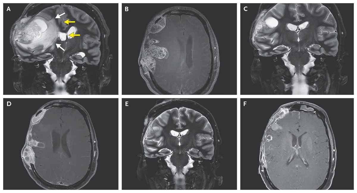 NEJM tweet picture