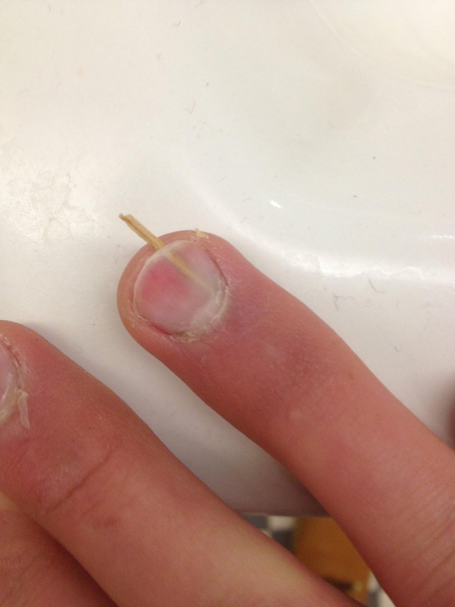 Joey___Sanchez's tweet photo. @RichardAngwin For each finger https://t.co/RT8kaeAxVi