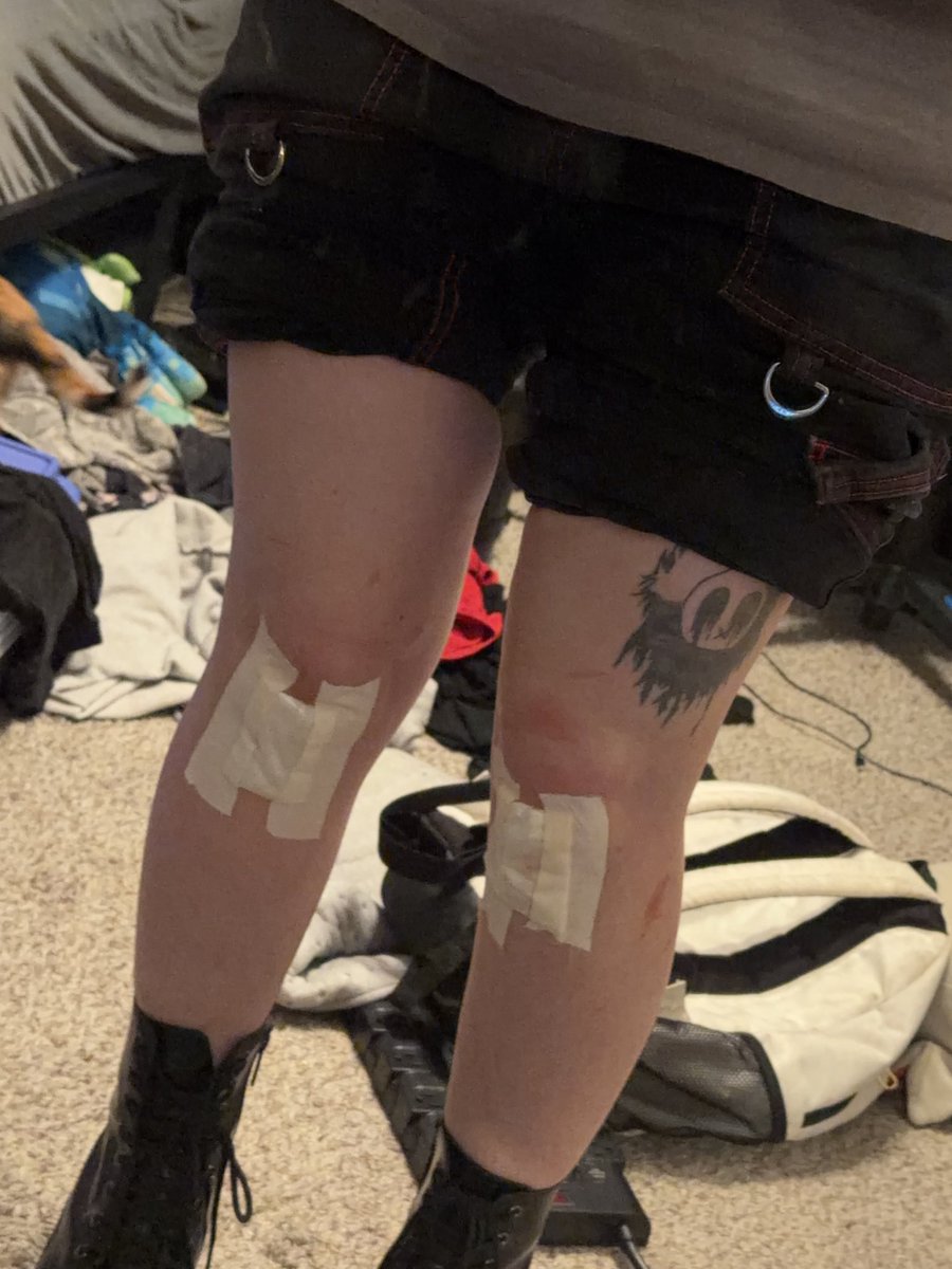 creeperstonerr's tweet photo. Do some people like when I’m scraped up or do I need to find a way to hide this until it heals😔 https://t.co/6s9YisuL6T