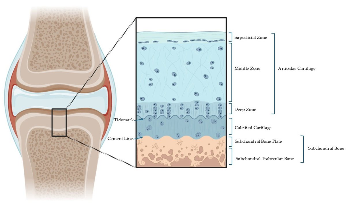 Bioeng_MDPI's tweet photo. 💥Excited for the publication: "Toward Integrative Biomechanical Models of Osteochondral Tissues: A Multilayered Perspective"
🔗https://t.co/piwJrVObSO
📌 #OsteochondralTissue #Biomechanics #RegenerativeMedicine #CartilageRepair #BiomedicalEngineering #InSilico #JointHealth https://t.co/k1aSxCMbZ7
