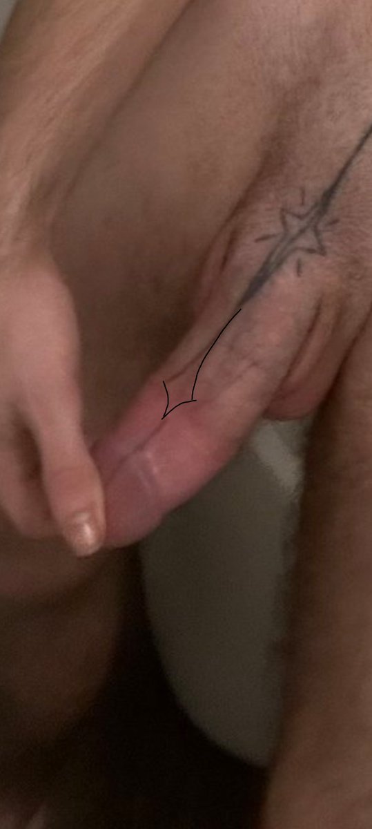 neobmax's tweet photo. @Linesbeleaking awww i bet it looked really nice uncut. unless it doesn't bother you, you could probably do another star to make it look symmetrical. maybe something like this? https://t.co/gmuuwyJX14