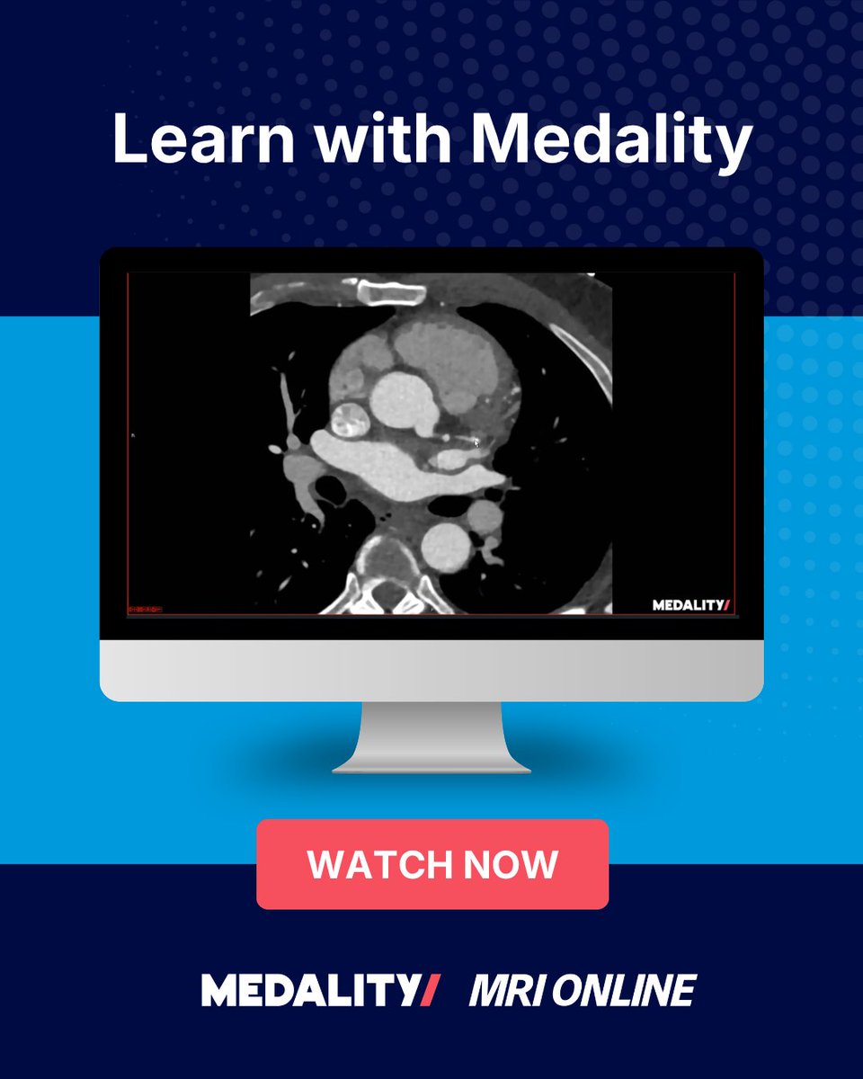 medalityhq's tweet photo. Does this patient have a mild, moderate, or severe stenosis? 

History: 51 year old with history of heart failure who came to the ED with chest pain. 

Watch the full case here: https://t.co/9jOo8RB8X9 https://t.co/yjaqZWycV7