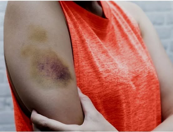 StopVirtuaStalk's tweet photo. If your pimp, trafficker, stalker, or former intimate partner brags about the bruises left on you without physically touching you, reach out to us ASAP. You've been tagged through tech. It is undetectable except through specific scanners. Img Src:Jay_Zynism/Getty Img #NSAM #HTAM https://t.co/cnkQ25gYir