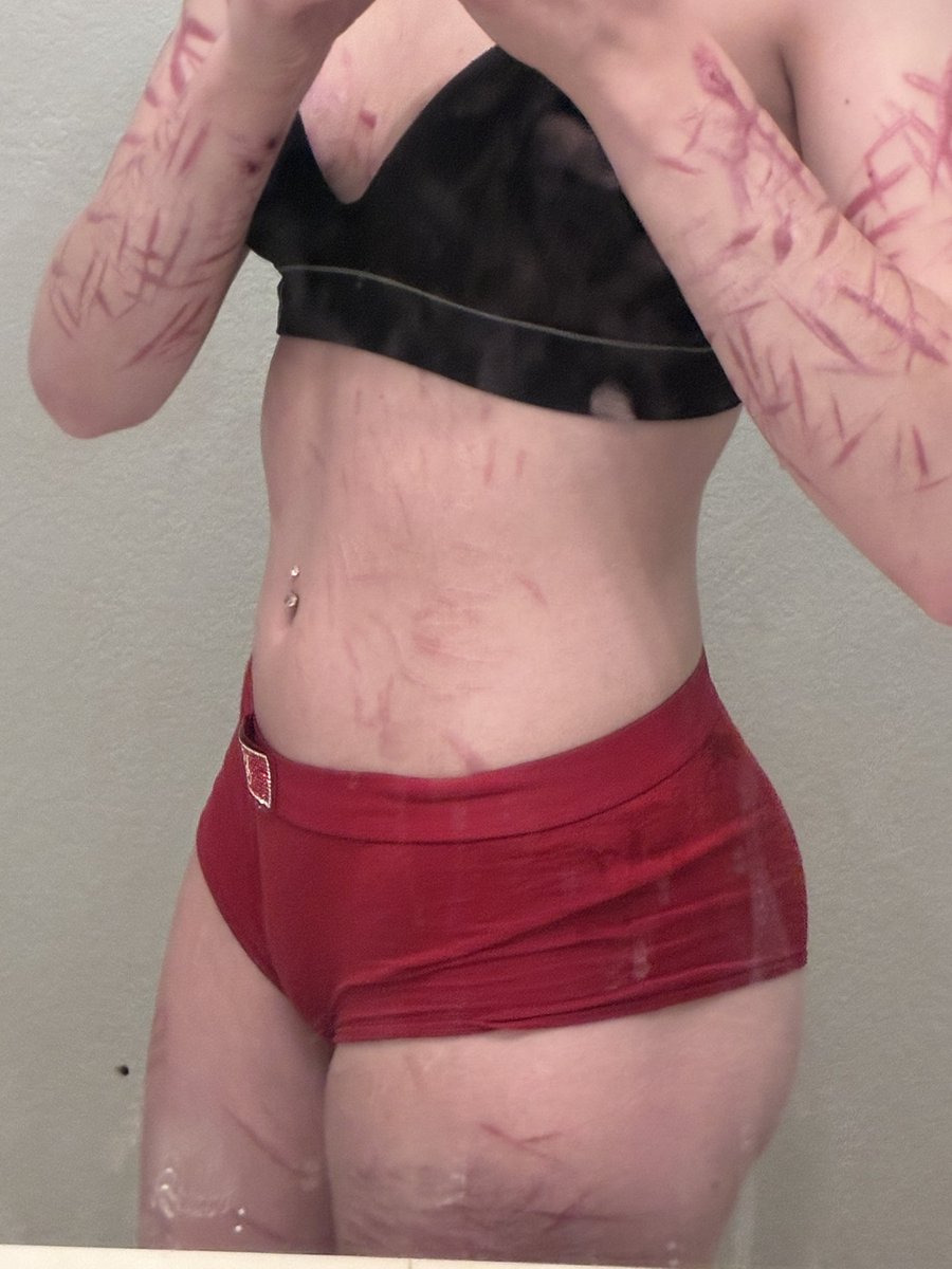 0_DewyRose_0's tweet photo. healing scarz n workout process https://t.co/QpTO67Ip2o