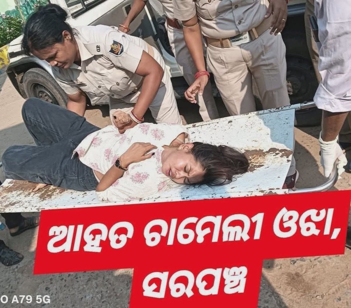 SujitSarangi3's tweet photo. ତିକ୍ଷୀରିପଂଚାୟତର ଭାଇରାଲ ମହିଳା ସରପଞ୍ଚ ଚାମେଲୀ ଓଝା ମହାକାଳପଡ଼ା ପୁଲିସ ମାଡରେ ଗୁରୁତରହେ!ଇ, ମେଡିକାଲରେ ଭର୍ତ୍ତି(ମହାକାଳପଡ଼ାବ୍ଲକରେ ଚାଲୁଥିବା ଦୂର୍ନିତିବିରୁଦ୍ଧରେ ନିରନ୍ତର ସ୍ଵର ଉତ୍ତୋଳନ କରି ଆସୁଥିଲେ) https://t.co/20QyqV9Swn
