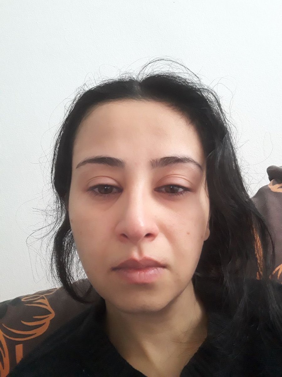 Sahar38433's tweet photo. عکس اول، قبل از کشته شدن علی.

حالا که نگاهش می‌کنم، انگار دارم به آدم دیگری نگاه می‌کنم؛ به دختری که هنوز می‌توانست از ته دل بخندد، هنوز نمی‌دانست زندگی‌اش قراره برای همیشه به دو قسمت تقسیم بشه : قبل از علی و بعد از علی.

آن خنده، یکی از آخرین خنده‌های من بود.

عکس دوم،بعد از کشته شدن علی تازه با کمک فیلتر.

فاصله‌ی بین این دو عکس را زمان پر نکرده؛ داغ پر کرده، اشک پر کرده، شب‌های بی‌خوابی پر کرده، و جای خالیِ کسانی که نباید از ما گرفته می‌شدن.

حقیقت این است که با رفتن عزیزامون،چیزی در وجود همه‌ی ما هم مُرد.#علی_محمدی