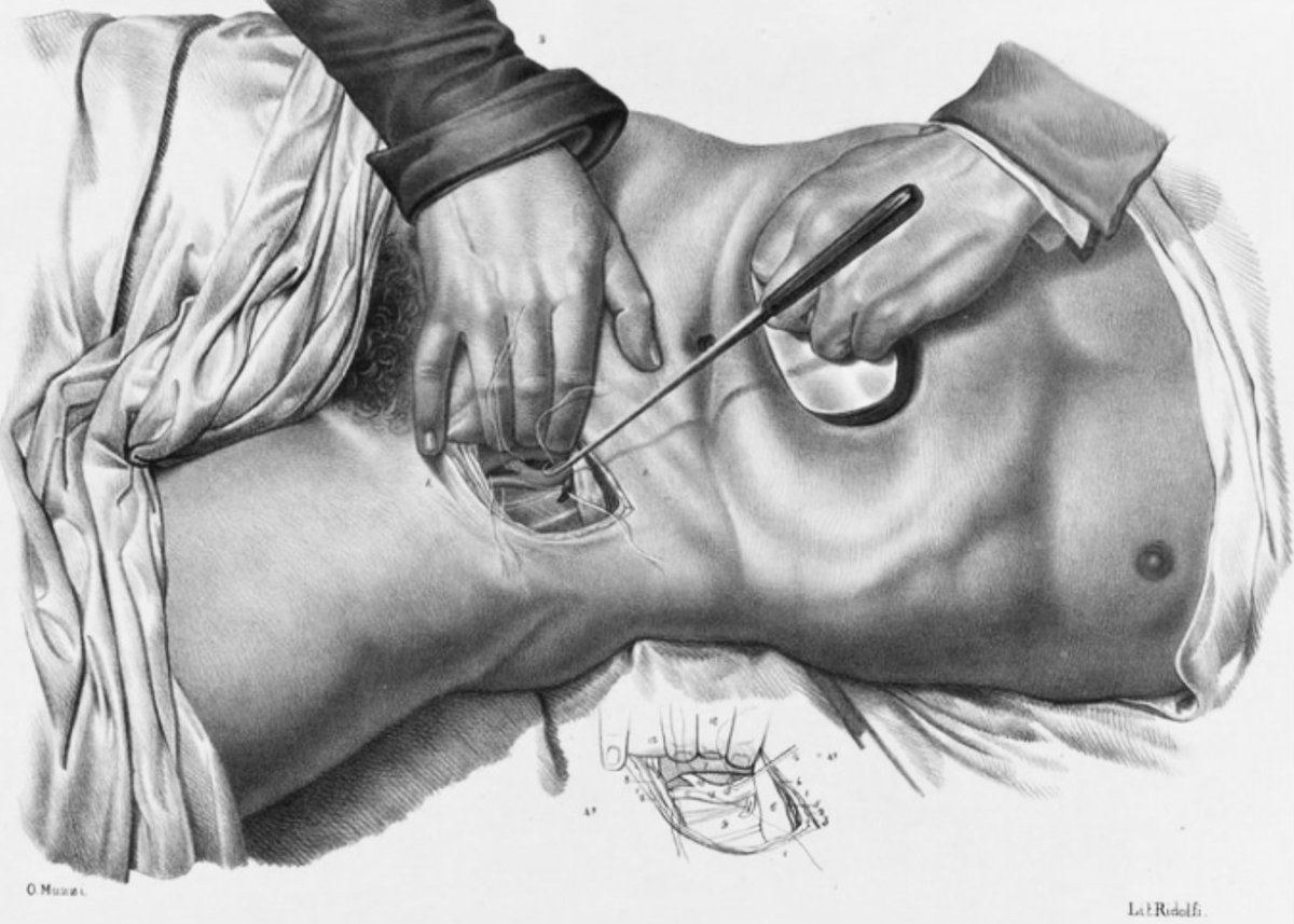 NurseTorture's tweet photo. Anatomical Erotes— the male body in the surgical theatre. https://t.co/W46RX2LtPm