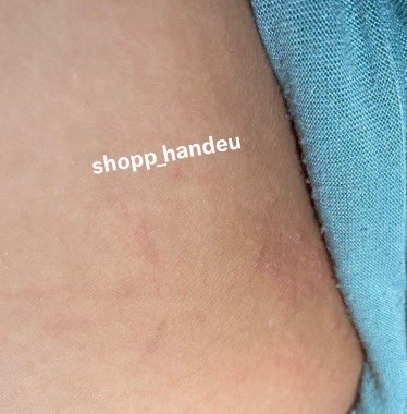 shopp_handeu's tweet photo. DARI KULIT AKU YANG DULU KAYAK GINI sekarang jadi yang kaya gini.

Pas awal sempet maju mundur mau beli, tapi pas di review sama MAMARI gue coba beli https://t.co/OD2F1yAjYM