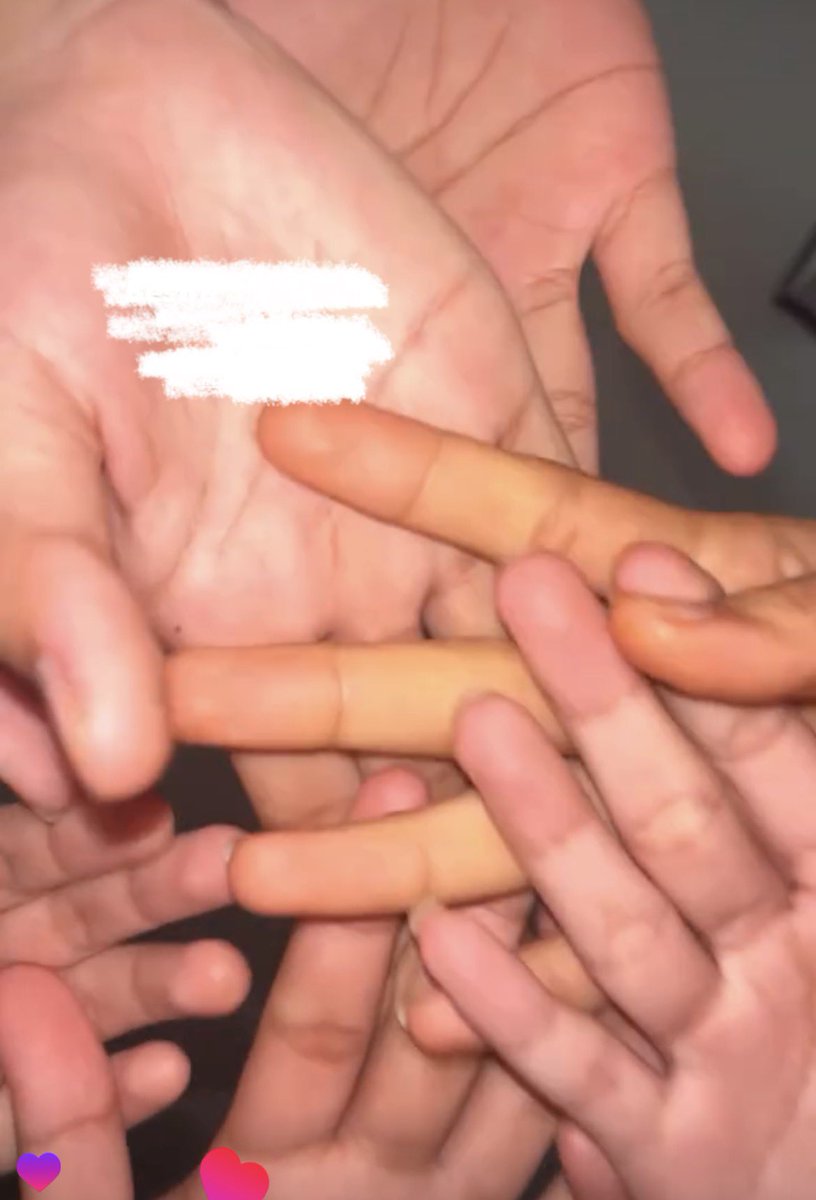 reobecca's tweet photo. @jodohseokjiniee @spicychickend @tirta_cipeng Kakk sorry baru respon😭 Alhamdulillah mendingan sih kak, walau masih sedikit lebih koneng daripada temen temen aku. 
Tapi ini ga sekuning duluu😭 (ini foto juni tahun lalu, aku udah mulai mengurangi makanan itu) https://t.co/Rz4GW0b8pn