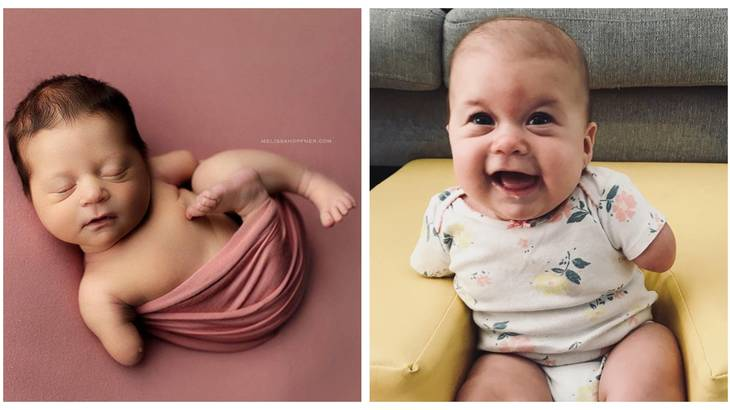 LifeNewsHQ's tweet photo. This is Ivy.

She was born without hands and forearms.

But her mother REFUSED to kill her in an abortion.

Vanessa McLeod felt devastated when she learned that her unborn baby was disabled.

The medical specialists only added to her fears when they suggested she have an abortion. She said they made her “feel guilty” for wanting her baby, and she began to doubt her ability to care for a child with special needs.

Vanessa knew she could not abort her daughter, Ivy, and her husband’s and parents’ encouragement helped more than anything else.

“I was still paralyzed with fear and worry for the remainder of my pregnancy, but my perspective began to shift,” she said. “Things just started to make sense, they started to fit. It felt right. I felt like the Universe chose me, out of millions of mothers, to be Ivy’s mom.”

She said she was 19 weeks pregnant when she found out that there was something wrong with her daughter.

She said her husband was away on a work trip, so her mother went along to her ultrasound appointment. Though it took longer than usual, she said they did not think anything was wrong.

The next day, however, her midwife called with the bad news. Her mother and father went with her to meet the midwife to learn more.

As Vanessa says:

“From the moment my midwife called me, up until we arrived at her office, I don’t think I stopped crying. I was terrified I was going to lose this baby. As my mom and I sat in the parking lot of my midwife’s office, preparing to go in, my mom looked at me and said, ‘Vaness, whatever it is, we’ll get through it.'"

The first thing the midwife mentioned was the possibility of a cleft lip, McLeod remembered.

“I began to feel hope. Was that all? Just something small, something cosmetic? … But there was more,” she wrote.

The midwife told her that the baby showed signs of heart problems and a femur that was curved and shorter than the other. Last, she told McLeod that her unborn baby did not have hands or forearms.

“This felt like a punch to the gut,” she recalled. “It stole my breath. It keeled me over and the sobs tore out of me, and visions of my perfect little baby shattered.”

However, her father left the office with words of encouragement: “’She’s going to be a blessing to our family. I think our family needs someone like her. She is going to teach us so much.’”

A short time later, she and her husband went to Vancouver Children’s Hospital to meet with specialists about their daughter’s condition. What happened was not what the McLeods expected.

She wrote:

I thought that meant we were getting answers that day — that the doctors could tell me why this happened, what caused it, and what the next step was. But the appointments were severely disappointing in that regard, and if anything, the doctors created more questions for us than answers, and tainted that whole experience with so much negativity. I wish with all my heart that appointment had gone differently. That someone had told us it would be okay. That someone had told us how beautiful and perfect our little girl would be, that she would smile and giggle and live a life filled with so much love. I wish I knew then what I know now. I wish I could take away all the worry, pain, fear, and heartbreak I felt. Instead, we got news of doom. All hope was taken away.

She said she felt shocked when the doctors suggested that they abort their baby girl. 

Though McLeod said she supports abortion, she never considered having an abortion herself.

“When my husband and I started to express that we wanted to keep her, the medical geneticist said, briskly and brutally, ‘But think about her quality of life. She’s going to have no hands,’” she remembered.

But her husband reassured her that they would make it work.

“’I’ll do whatever I have to do to take care of her,’” he told her. “’I’ll build her anything. I want her. I’ll do whatever it takes. I’ll take care of her for the rest of her life.’”

His words gave her hope.

A few months later, Ivy arrived, premature but beautiful – and absolutely valuable.

“The moment I birthed her and held her in my arms, I felt so much peace,” her mother said. “And when she opened her eyes and looked at me for the very first time, I knew she was exactly where she was meant to be.”

McLeod said she wants to the world to know that her daughter is valuable, no matter what she looks like or what she is able to do.

“Some people have blue eyes, some have green. Some have blonde hair, some have brown. Some are born with hands, some without,” she said. “And I hope I can always impart to her that her life has meaning, has value, and will always be filled with so much love, regardless of her appearance or abilities.”