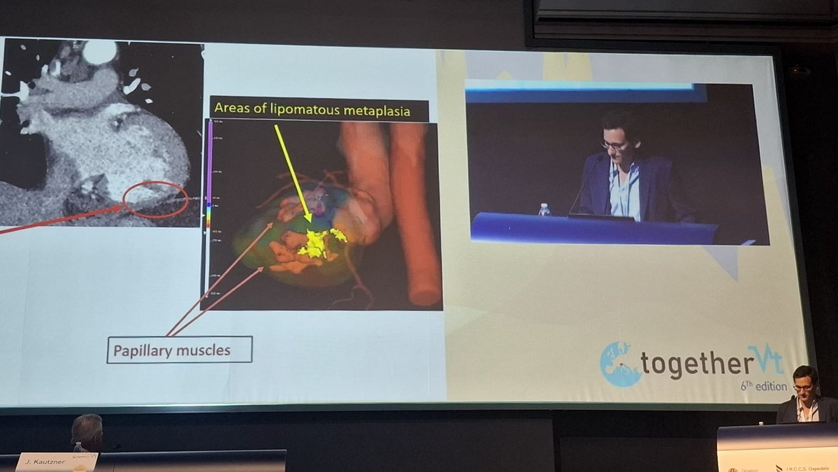 JoseA_fdez12's tweet photo. Nice to be here at Milan in #togetherVT
Huge congress with amazing faculty and a pleasure to share the experience with colleagues from @ArritmiasGr @pjsm83 @TorcuatoGAJ @Eva_CabreraB https://t.co/u0eR5kcs1d