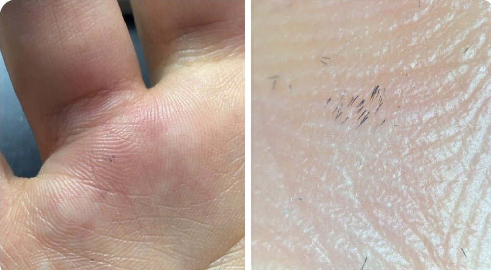 VibeVaults_'s tweet photo. After cutting through the bushes, my hand started hurting, and when l looked closely, I saw a thorn? stuck in it.
Looking at it under a microscope, it's this size, so pretty tiny. https://t.co/vHTz8cWAXf