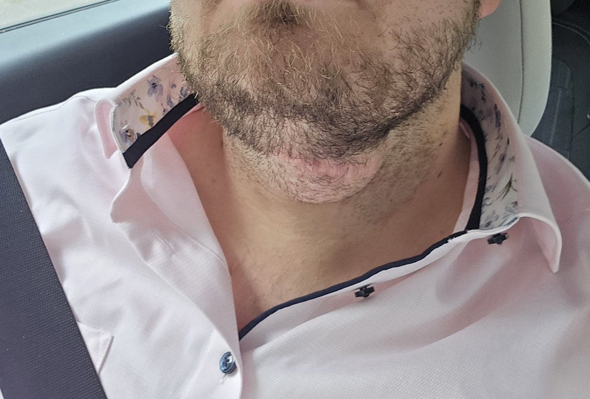 Patrick39967495's tweet photo. @oui_violet Hab seit 6 Jahren so eine wiederkehrende Zyste... 3 mal operiert und keiner weiß genau was das ist. Diesmal wohl vom zungenbein...Drücke dir die Daumen, dass die helfen können. https://t.co/xYzAynNY2n