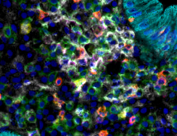Science Translational Medicine tweet media