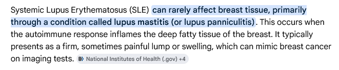 gwingrin's tweet photo. Rheumatois arthritis test came back. Negative. No one's surprised.

Lupus test hasn't come back yet.

But I was hospitalized for kidney pain and a UTI caught despite celibacy and OTT evacuative hygiene the same week as a breast cancer scare this month.

Might not be lupus. But... https://t.co/TO6Qc4XfaZ