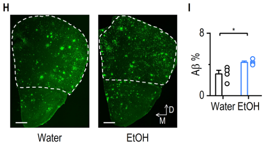 WangLabTAMHSC's tweet photo. Excited to announce our new publication in Neuropharmacology, showing that chronic alcohol exposure produces pathology-dependent corticostriatal circuit remodeling in mouse models of Alzheimer's disease! This paper is available now and linked below. https://t.co/Yus3AXauXR