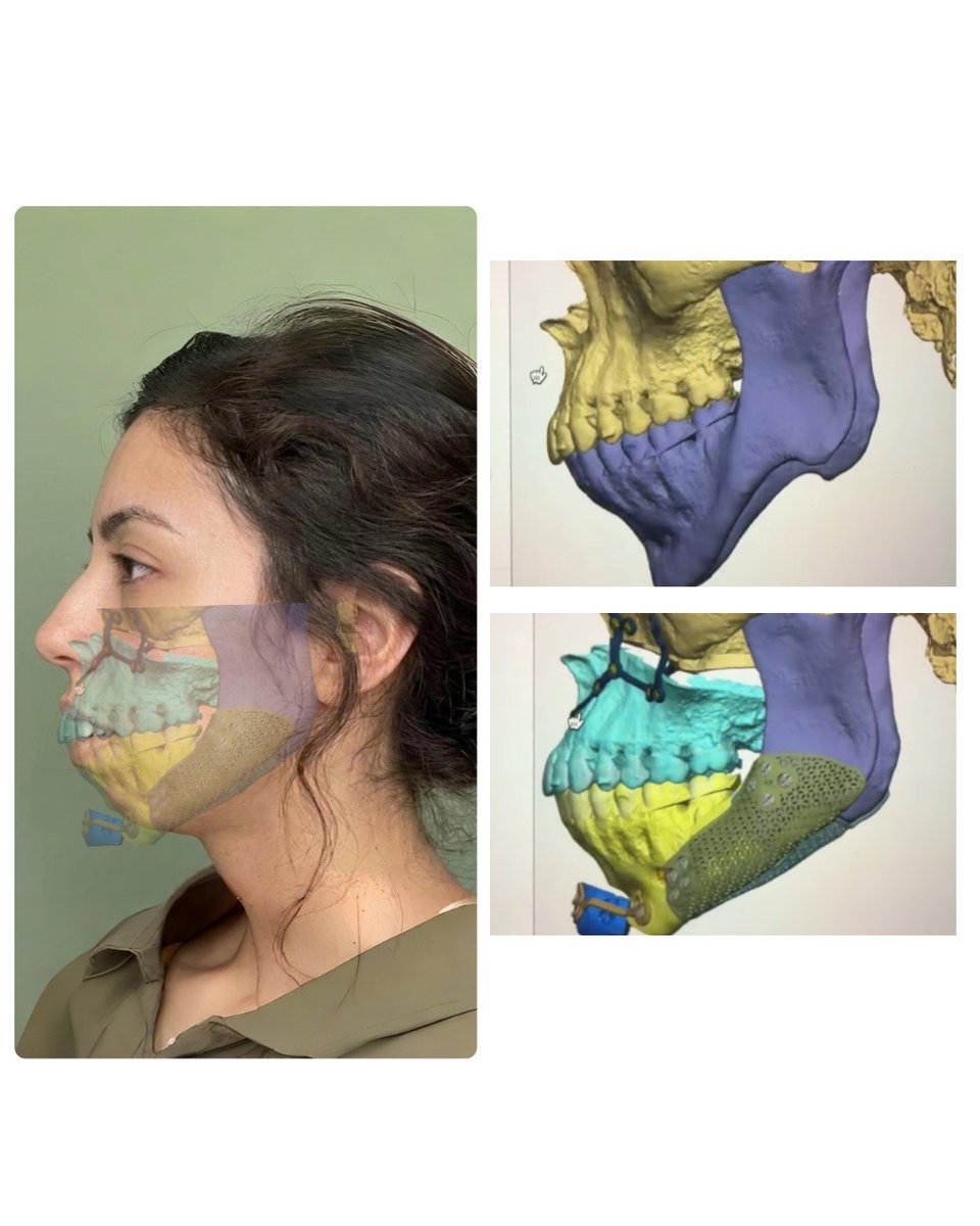 BIOHACKER.LOOKSMAX tweet media