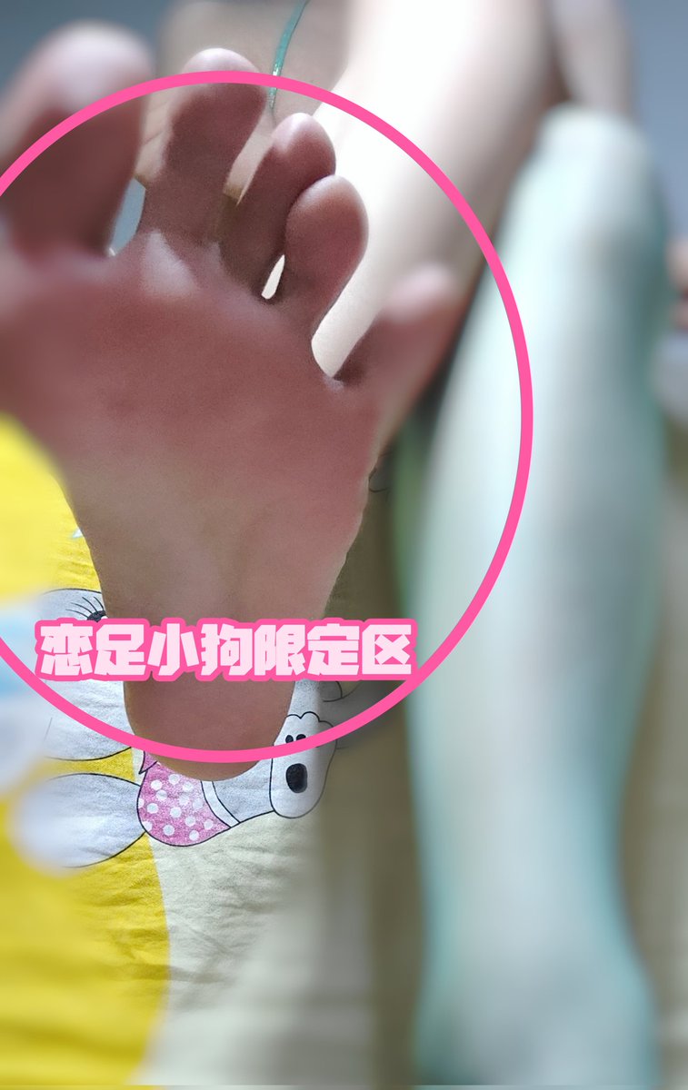 chayeshu02's tweet photo. 天气热了穿人字拖脚巨酸无比，有无神医治疗一下 #足底 https://t.co/cIktY7dQjy