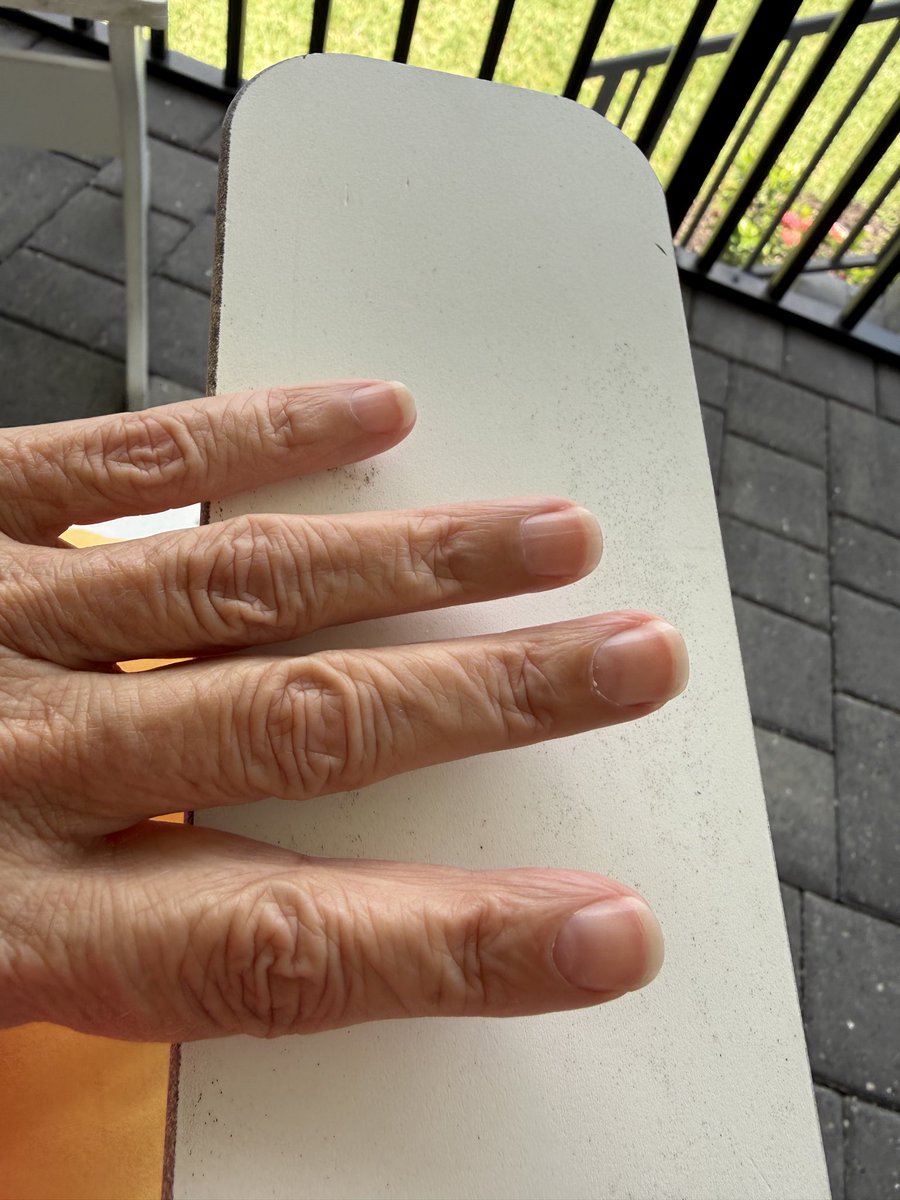 SRCLARK3FL's tweet photo. @saniyafatma1278 I play tennis a lot and work on my laptop- fake nails and gels ruined my natural ones https://t.co/6AR5uvLLHK