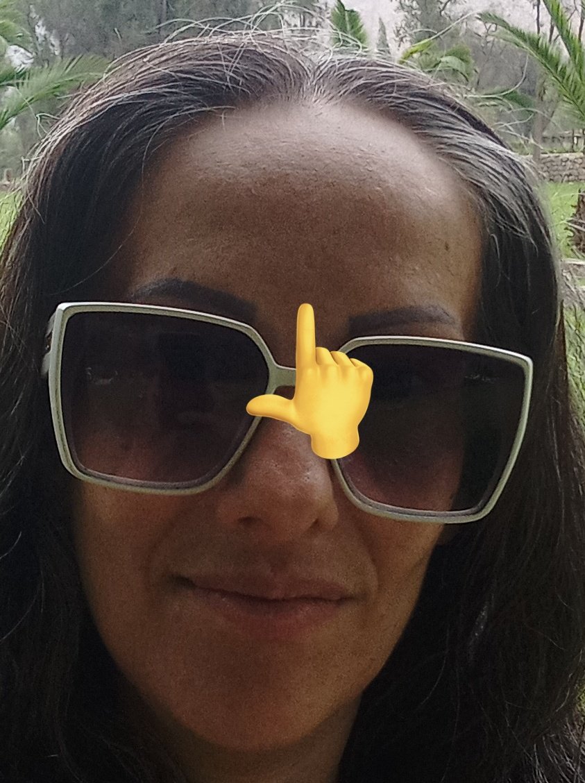 Smsfa04's tweet photo. @iamauryr 😂😂😂😂😂😂😂😂

Somos hermanas de cicatriz. Lo único en común que tengo con @shakira 

Seguro también le dió lechina y se rascó 😂 https://t.co/M1tZEdP6UN