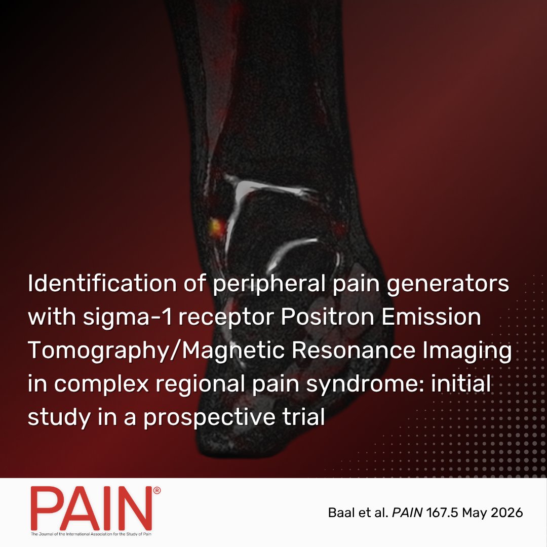 PAINthejournal's tweet photo. Baal et al. find that [18F]FTC-146 PET/MRI of sigma-1 receptor identified peripheral pain generators of complex regional pain syndrome, subsequently guided targeted treatments, and achieved varying degrees of improvements. Learn more in #PAIN https://t.co/xhNwvGhQM7 https://t.co/EQY3U1Rntw