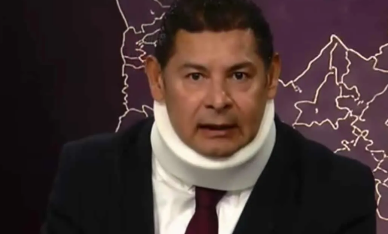 PFifiona's tweet photo. El collarín médico que utiliza el gobernador de Puebla obedece a una lesión en la columna y el cuello, derivada del desgaste físico acumulado debido al peso de sus orejas... https://t.co/DHMXIyd8TW