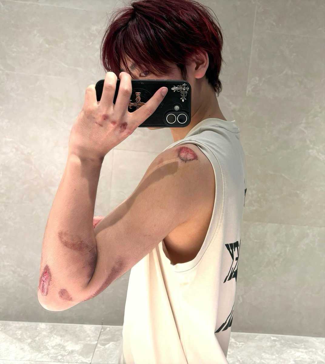 PMKYAXVMj3ne6MP's tweet photo. 再也不想喝酒了 差点摔死我 https://t.co/LSh9ByQZ8p