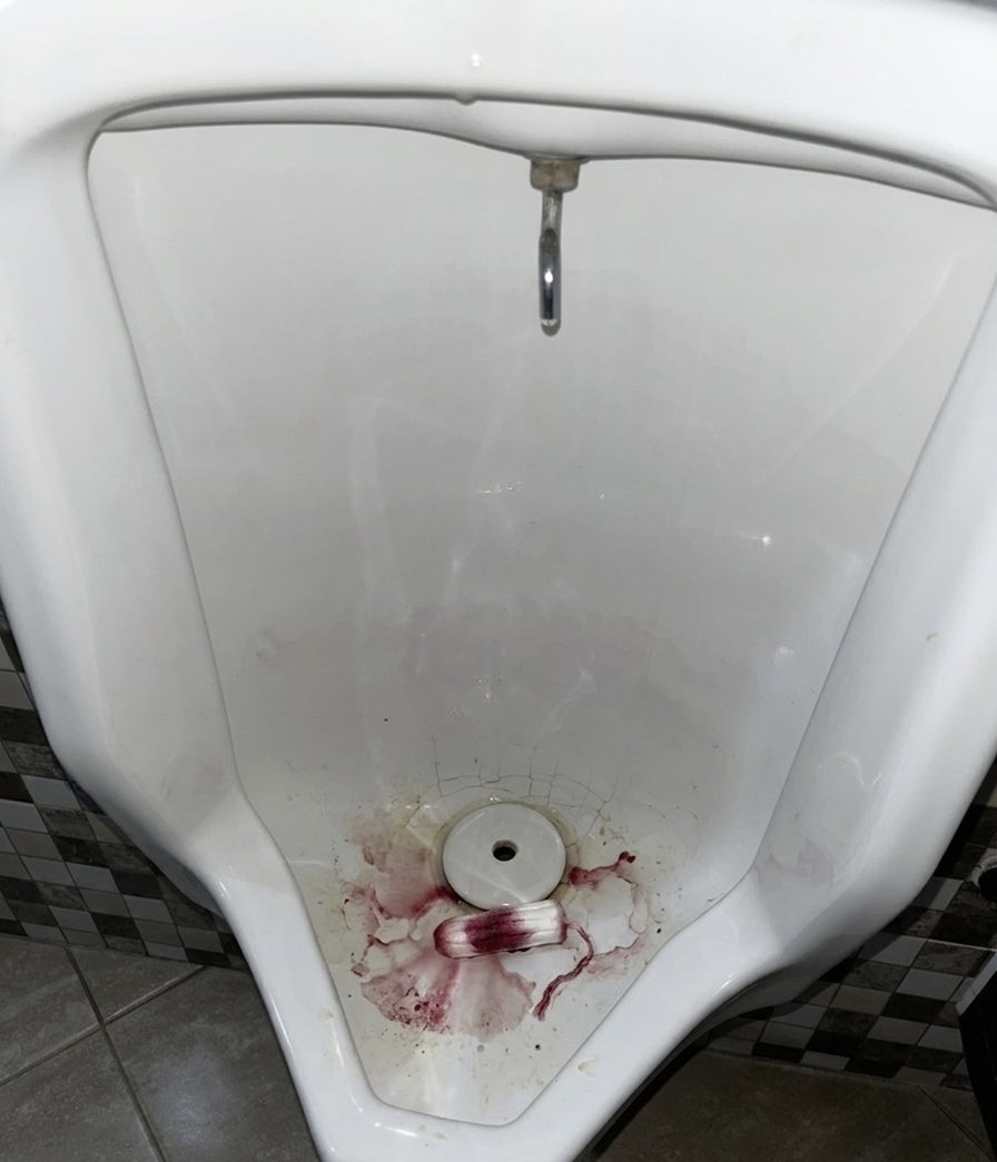 madnabiel's tweet photo. EH ANJG INI SIAPA YANG BUANG BEGINIAN DI TOILET COWOK🤮🤮🤮⁉️⁉️⁉️ https://t.co/T2Q1qp2WJO