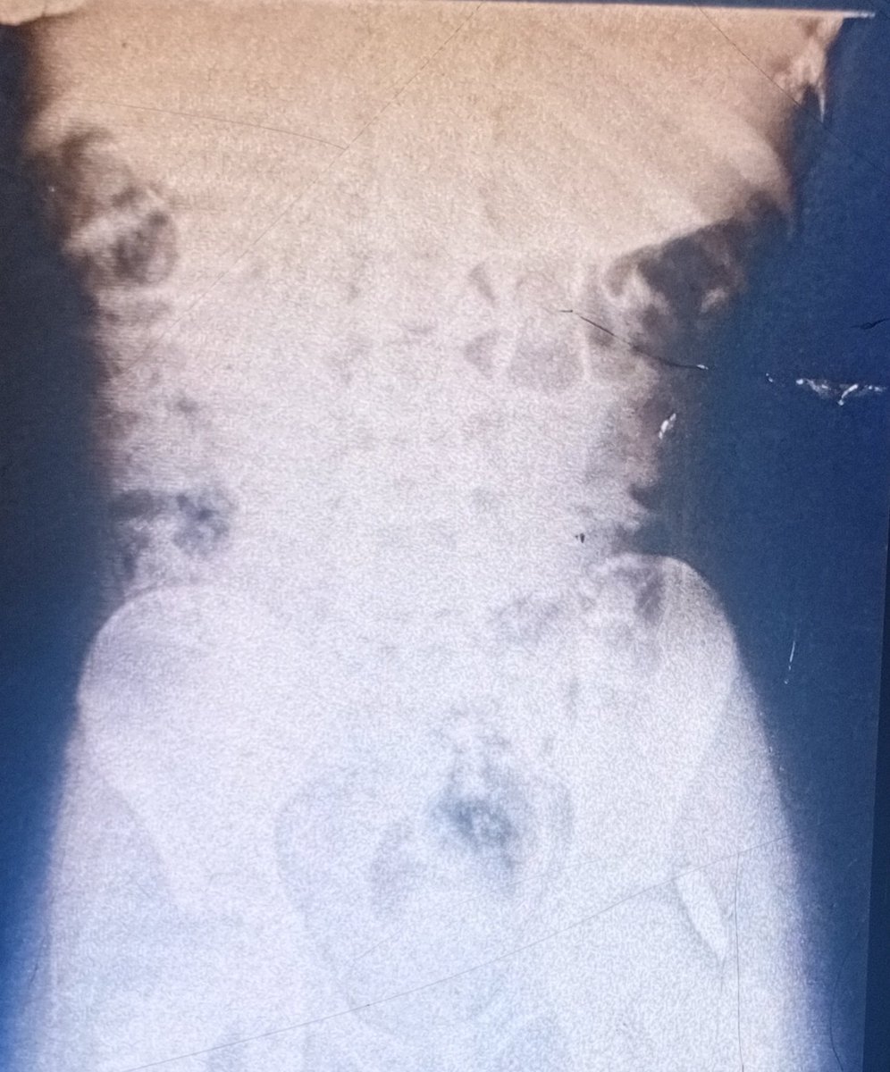 abw27916's tweet photo. Please pray for my sister. She was shot last night and the bullet is lodged in her body. 🙏 https://t.co/ap0oSRMac9