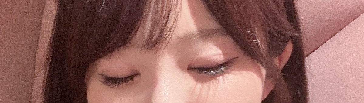 gokigen_chiwawa's tweet photo. プロミス整形外科で二重切開してから４ヶ月経過ჱ̒ ᴖ⩊ᴖ ） 整形感がなくて生まれた時からこの二重でしたってくらい自然❣️目を瞑ってもあまりわからない…！ https://t.co/HJKlKvNErs