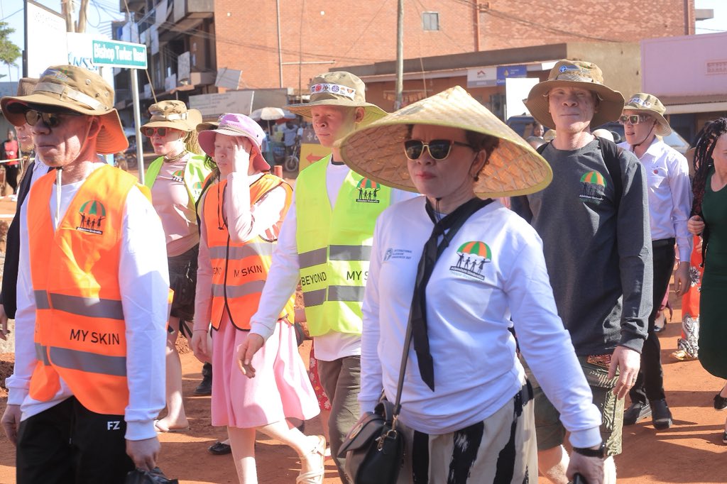 albinismumbrell's tweet photo. ⏳ ⏳ 1 Day to #IAAD2026

Tomorrow, all roads lead to Boma Grounds, Kamuli District, where we shall join @SNUPA6 to celebrate the International Albinism Awareness Day🎉

We shall be proudly in our skin, celebrating all skin tones as we raise awareness on albinism-related issues. https://t.co/MVEKTR5mGE