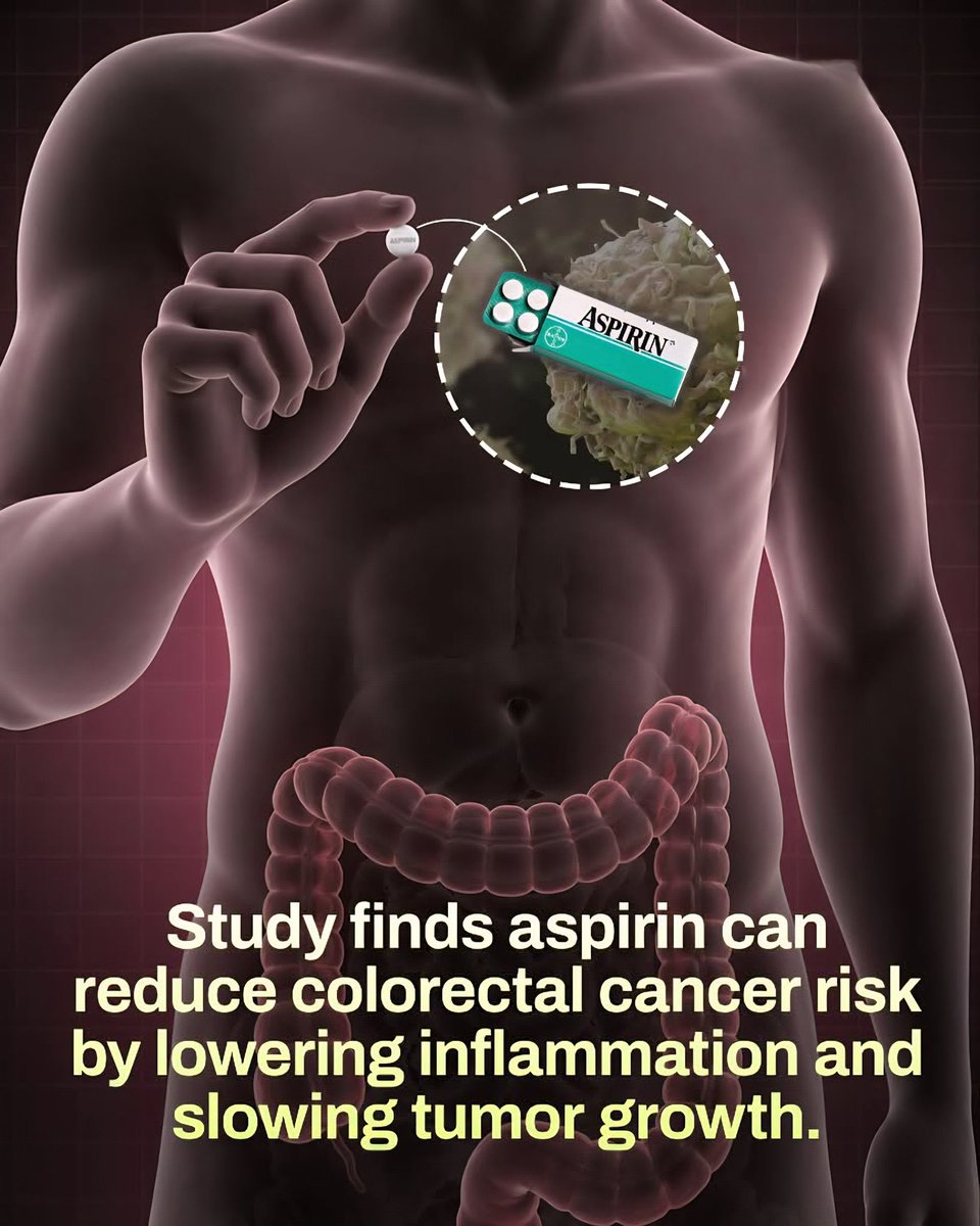 SmartScience's tweet photo. Aspirin, a common pain-relieving drug, has been shown to reduce the risk of colorectal cancer, especially in high-risk individuals.

It works by lowering inflammation, slowing tumor growth, and helping the immune system detect cancer cells.

However, due to potential side effects like bleeding, it should only be used for prevention under medical guidance.
