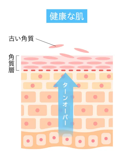 cherchoeur's tweet photo. 「なんなん！！？？このお風呂上がりの白いモロモロ！」無理やり取るのは今すぐやめてください！バリア低下＆ヒリヒリの原因になるからです。
まずスキンケアの基礎を見直してみて！ 
洗顔しすぎてない？セラミドやNMFでしっかり保湿できてる？こすってない？どうしても気になる時は保湿クリームでなじませてください！