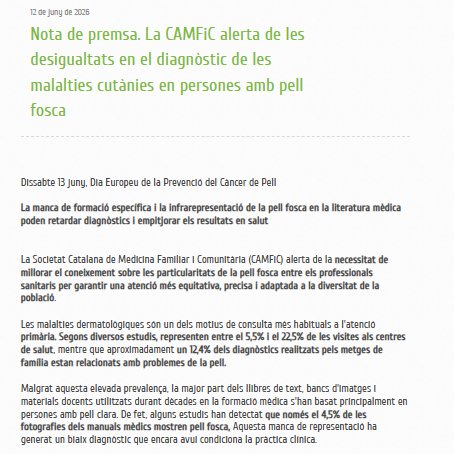 CAMFiC's tweet photo. ▶️ Amb motiu del Dia Europeu de la #Prevenciócàncerpell, la CAMFiC alerta de les desigualtats en el diagnòstic de les malalties cutànies en persones amb pell fosca.

🗣️"La medicina no és neutral quan el coneixement es construeix a partir d'una part de la població i deixa la resta en un segon pla”, alerta la Dra. @albasatorres  del GdT Dermatologia @lapellcamfic 

Consulta la nota: https://t.co/y9ErKWLwJ6