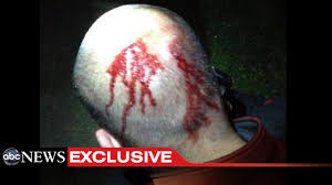 sh3333it's tweet photo. @3than_A @whiningdogs @ImMeme0 @ArmyAFMom I don't think you understand how the justice system works. Florida charged Zimmerman with murder. And the jury found that he was clearly the victim of a violent chimpout. Poor lil baby Trayvon could have been charged with attempted murder had Zimmerman not dispatched him to hell. https://t.co/bkOoGpI6F8