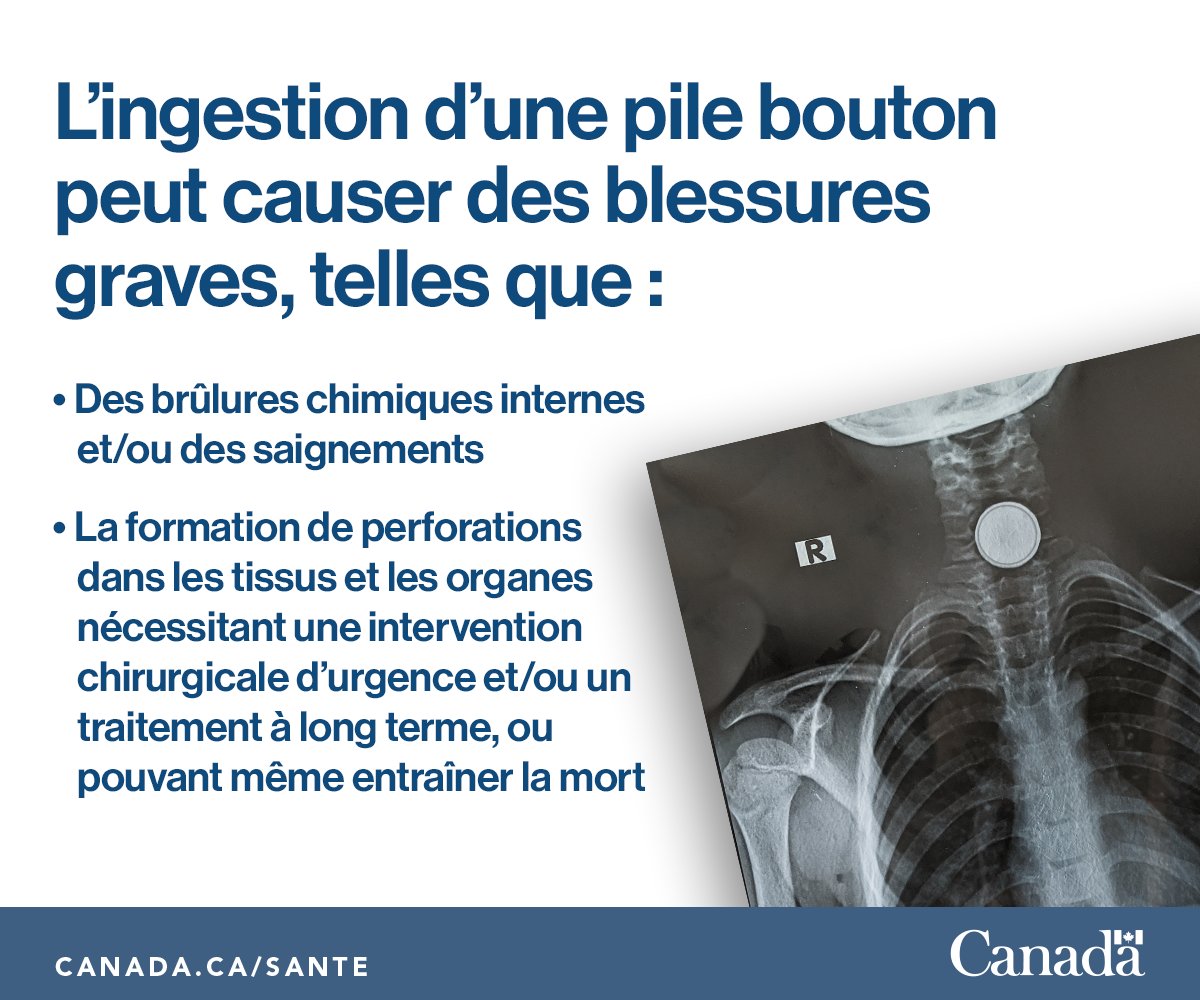 ca_temu's tweet photo. Les petites piles représentent un risque majeur pour les enfants. Conservez-les en lieu sûr pour éviter des blessures potentiellement mortelles.
@GouvCanSante https://t.co/Aiw2MjY5da