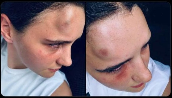 AngryJock1's tweet photo. @MrAndyNgo Here is her little sister that was beaten and threatened before hand.  This is why the Dundee Girl had to get an Axe
https://t.co/jmwPbzpJYd https://t.co/dPUXIpkU1E