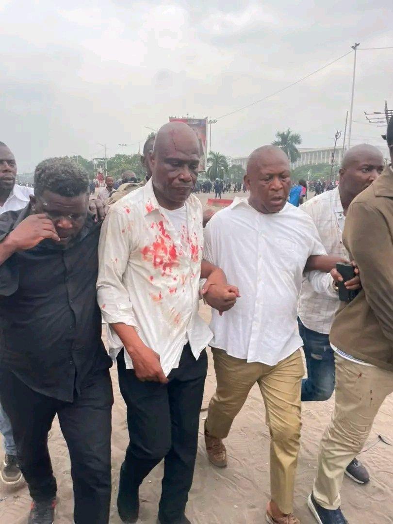 ArthurAtan40982's tweet photo. Union pour la Démocratie et progrès social. UDPS en sigle🤷

MAFA courage à toi !

Le peuple congolais est fière de toi https://t.co/izgthrsdSO