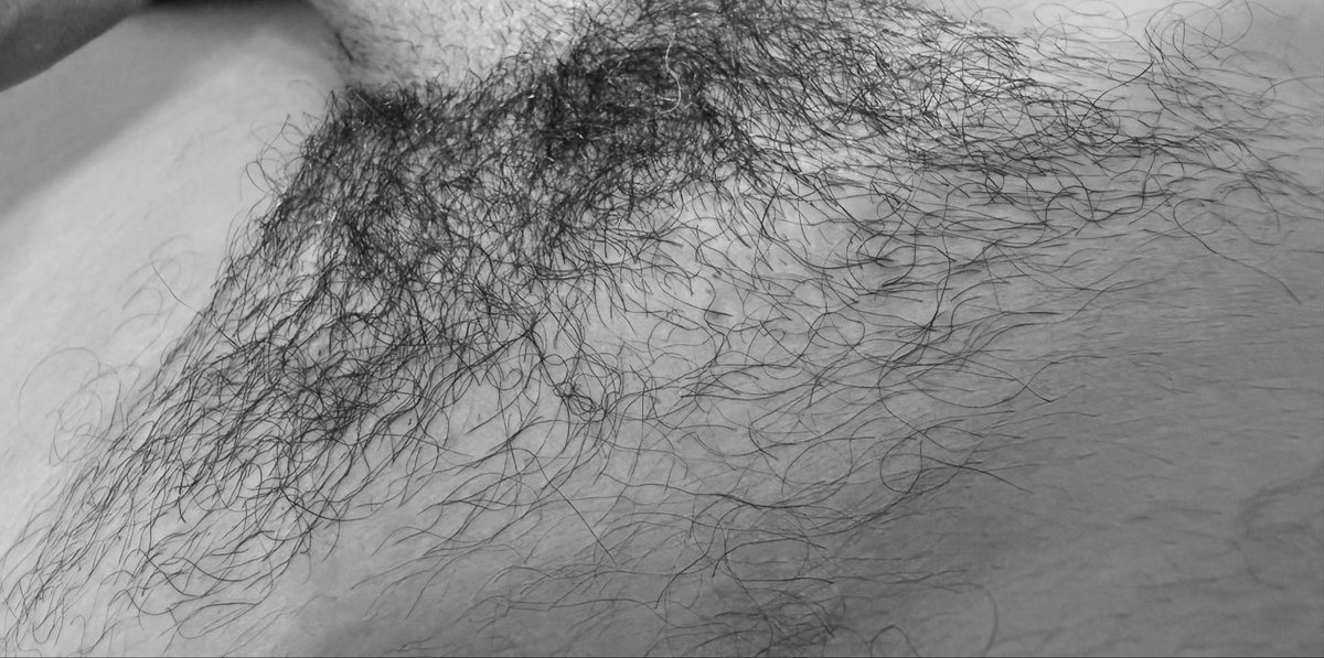 JAYOPXPI's tweet photo. A bit hairy… https://t.co/wfNVaDkZuu